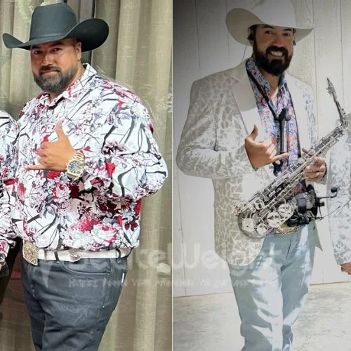 Jesse R - Gastric sleeve update after 1 year*